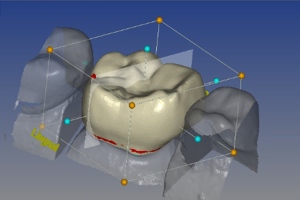 3D Imaging and Printing in Dentistry