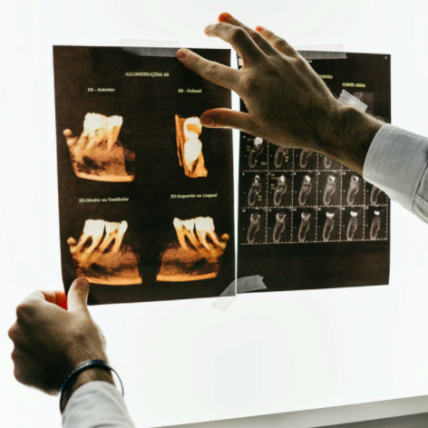 Are Dental X-Rays Safe?