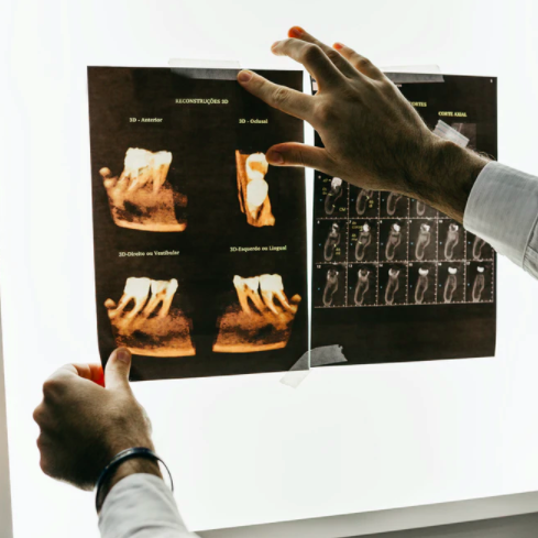 What to Do If You Chip a Tooth